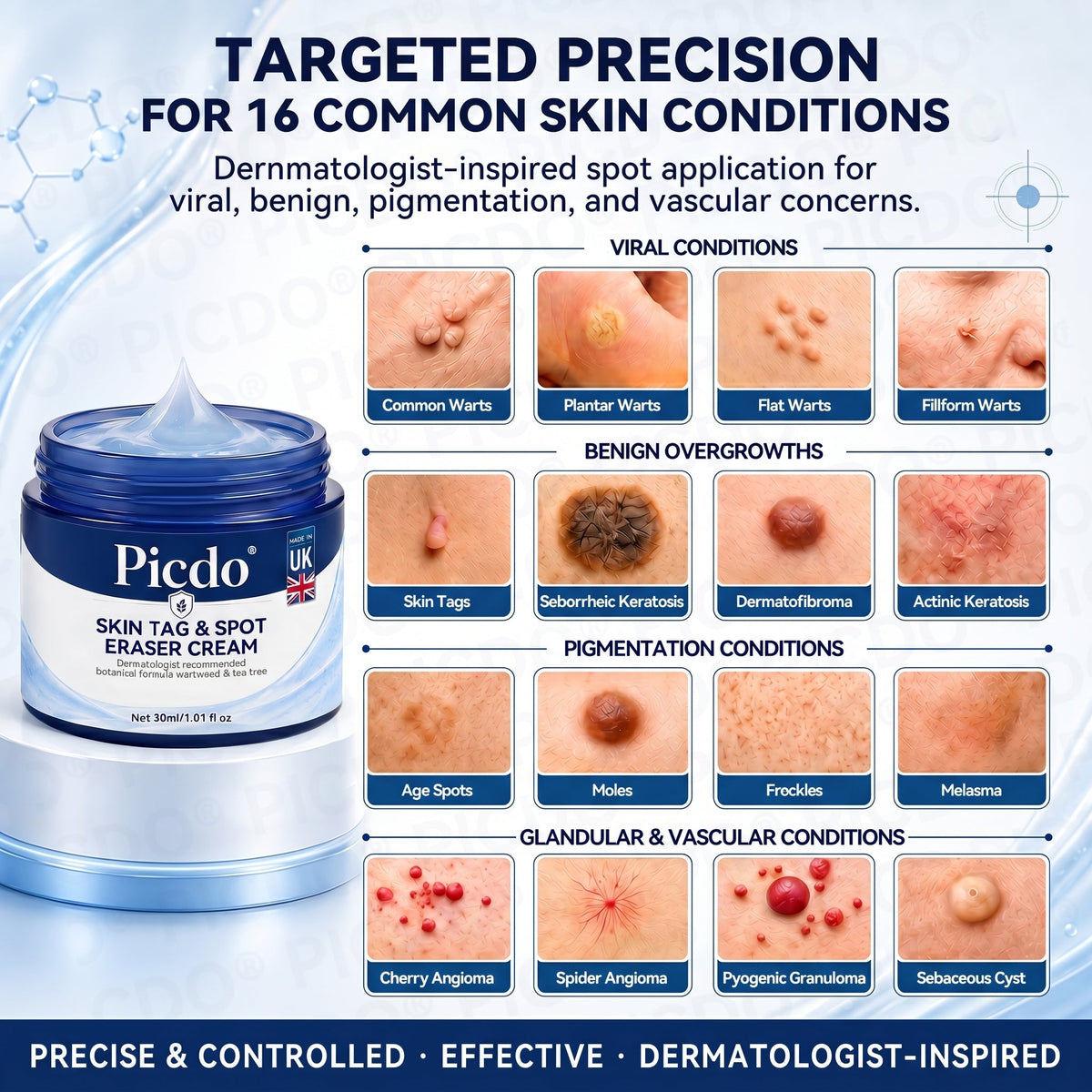 𝐏𝐢𝐜𝐝𝐨® 7-𝐃𝐚𝐲 𝐒𝐤𝐢𝐧 𝐓𝐚𝐠 & 𝐒𝐩𝐨𝐭 𝐄𝐫𝐚𝐬𝐞𝐫 𝐂𝐫𝐞𝐚𝐦🩵(Zero Pain, Zero 𝐒𝐜𝐚𝐫𝐬 Formula)🍁