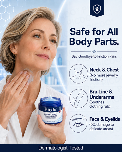 𝐏𝐢𝐜𝐝𝐨® 7-𝐃𝐚𝐲 𝐒𝐤𝐢𝐧 𝐓𝐚𝐠 & 𝐒𝐩𝐨𝐭 𝐄𝐫𝐚𝐬𝐞𝐫 𝐂𝐫𝐞𝐚𝐦🩵(Zero Pain, Zero 𝐒𝐜𝐚𝐫𝐬 Formula)🚀